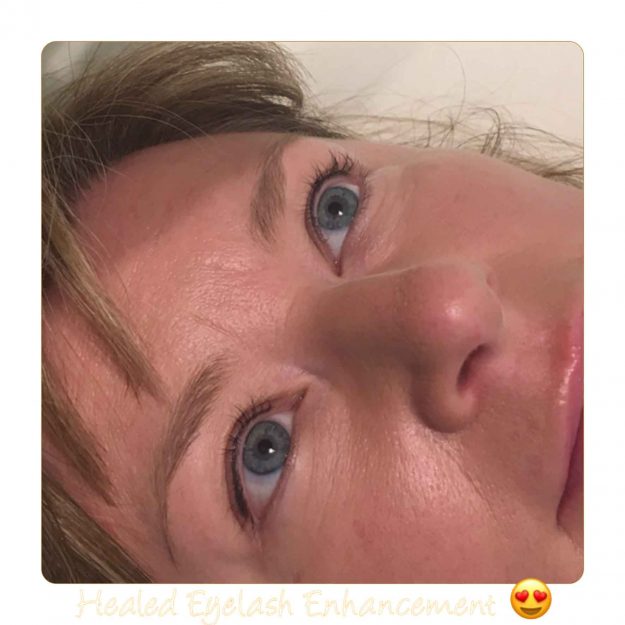 Melanie Aslin Permanent Makeup- Debbie Healed Eyeliner