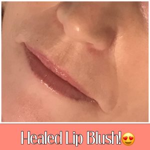Melanie Aslin Permanent Makeup- Darain Lip Blush 2nd Session Healed