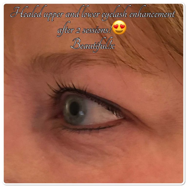Permanent Makeup Upper And Lower Eyelash Enhancement Permanent Makeup Upper And Lower Eyelash Enhancement